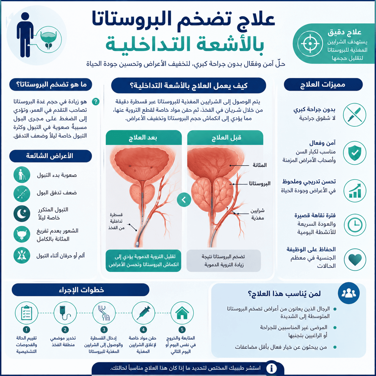علاج تضخم البروستاتا بالاشعة التداخلية
